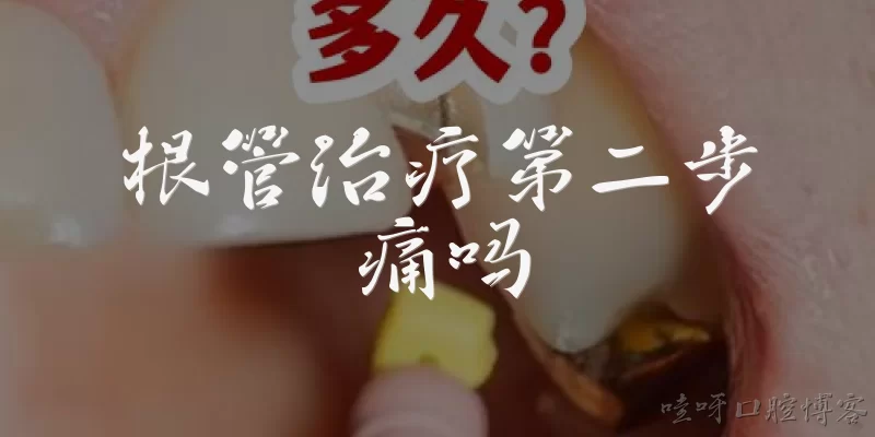 根管治疗第二步痛吗:根管治疗第二步痛吗？