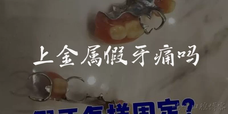 上金属假牙痛吗