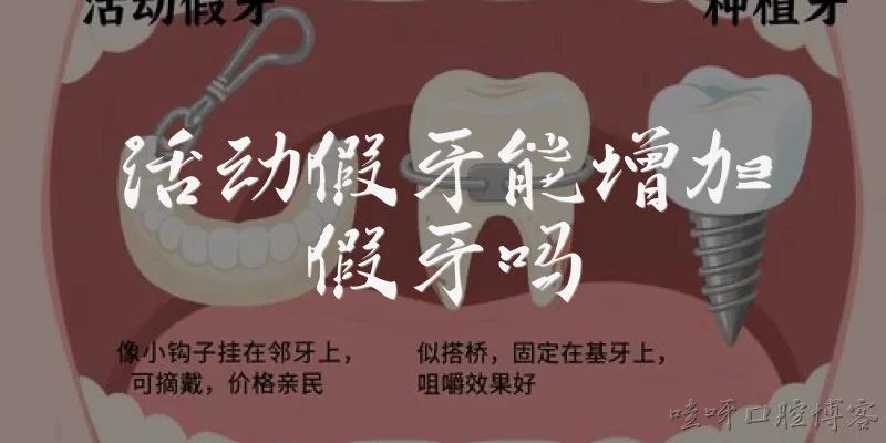 Can removable dentures add teeth?