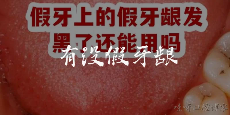 有没假牙龈
