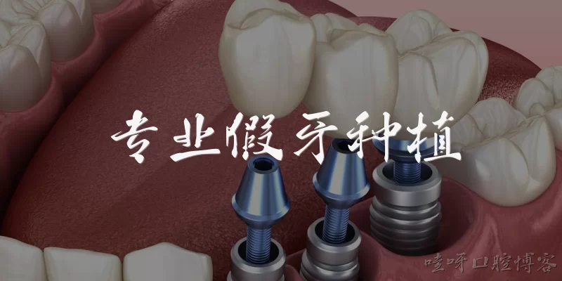 专业假牙种植