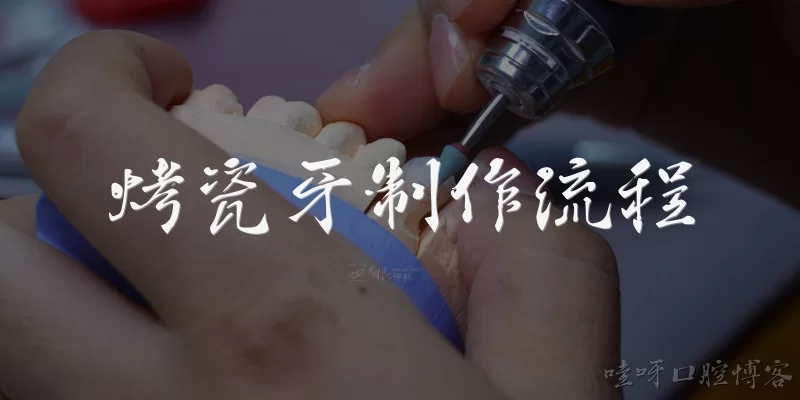 烤瓷牙制作流程