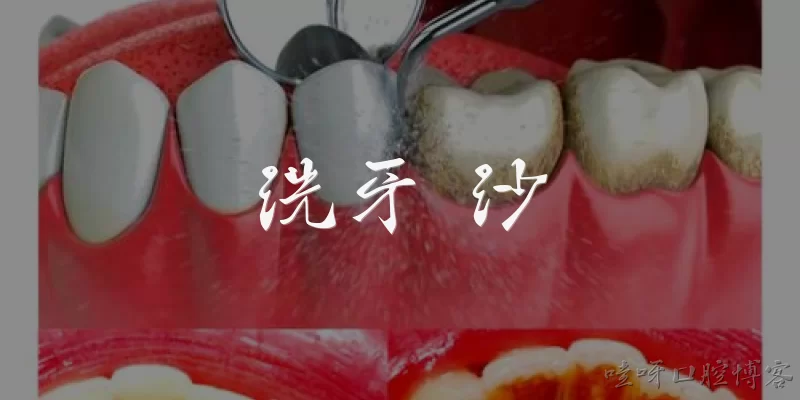 Teeth Cleaning Sha
