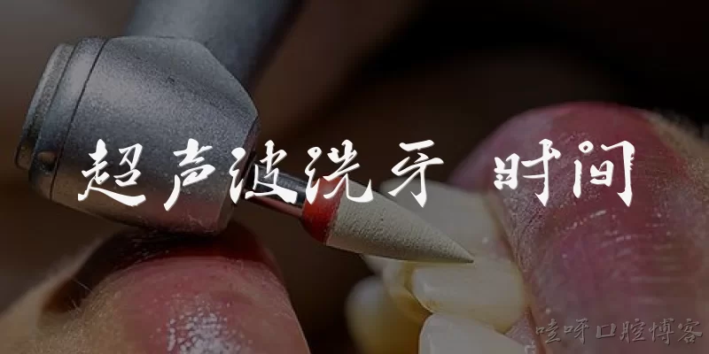 Ultrasonic Teeth Cleaning Time
