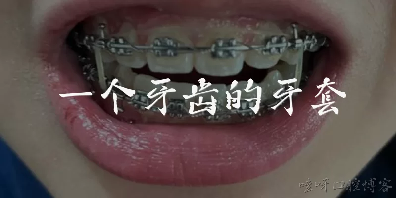 一个牙齿的牙套:2026年做一个牙齿的牙套需要多少钱？