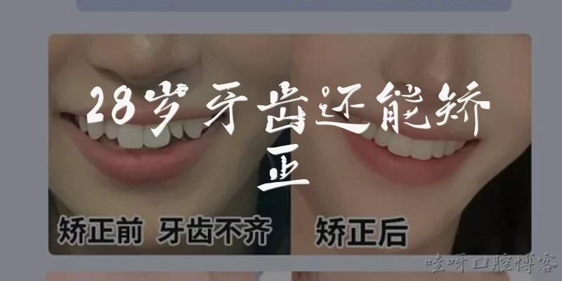 28岁牙齿还能矫正