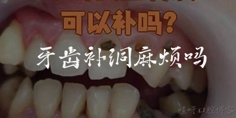 牙齿补洞麻烦吗