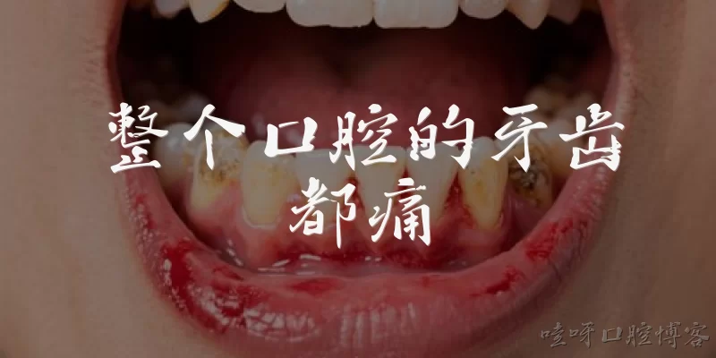 整个口腔的牙齿都痛