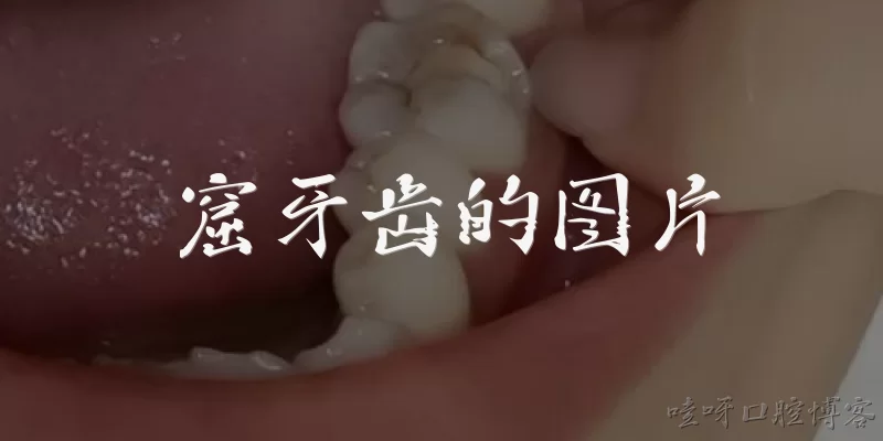 窟牙齿的图片