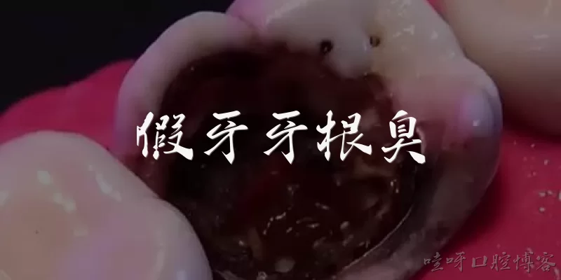 Denture root odor