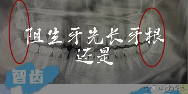 阻生牙先长牙根还是