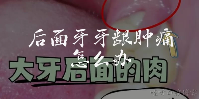 后面牙牙龈肿痛怎么办
