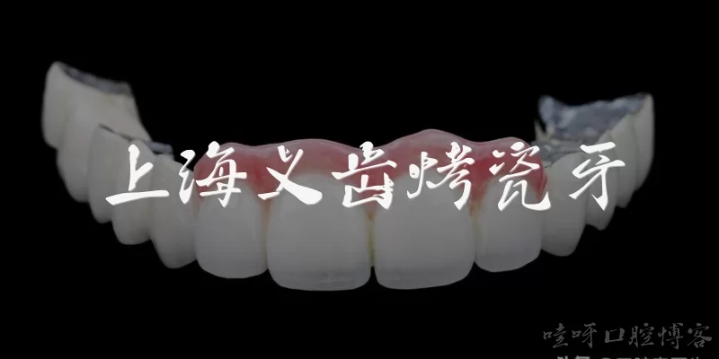 上海义齿烤瓷牙