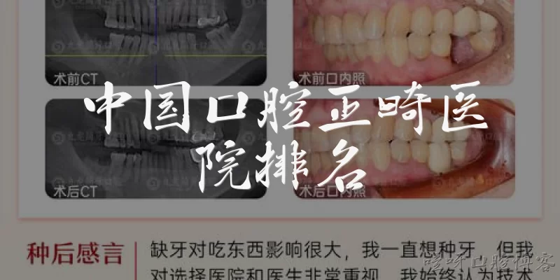 中国口腔正畸医院排名