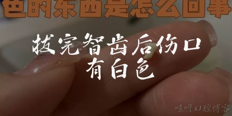 拔完智齿后伤口有白色