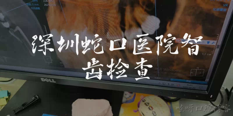 深圳蛇口医院智齿检查