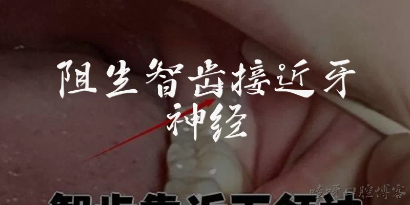 阻生智齿接近牙神经
