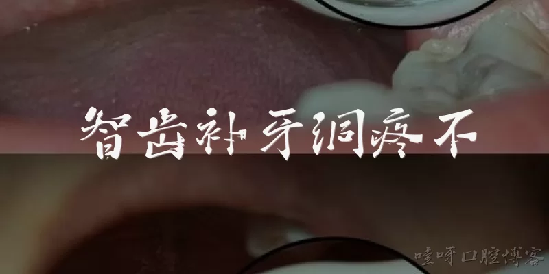 智齿补牙洞疼不