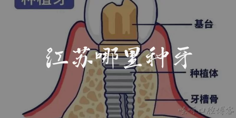 江苏哪里种牙