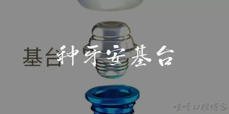 种牙安基台