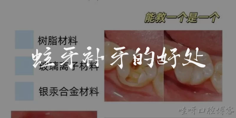 蛀牙补牙的好处:蛀牙补牙能阻止龋坏继续发展吗？