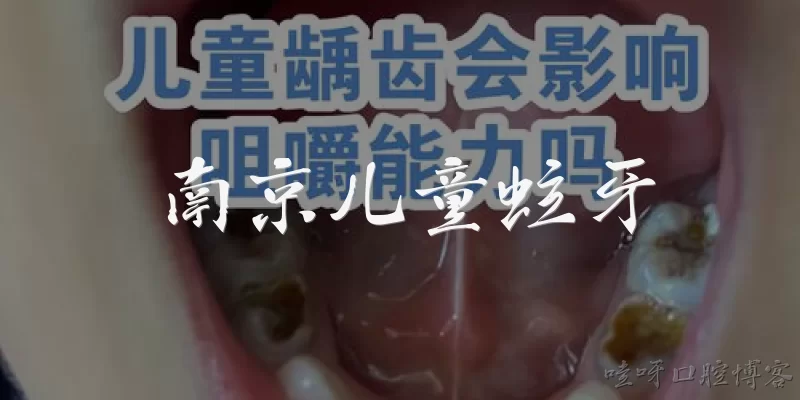 南京儿童蛀牙:南京儿童蛀牙的患病率有多高？