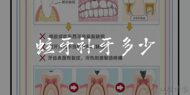 蛀牙补牙多少